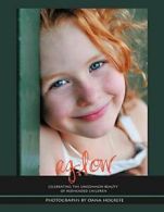 Aglow: Celebrating the Uncommon Beauty of Redheaded Children. Hogrefe, Oana.#