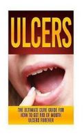 Migan, Wade : Ulcers: The Ultimate Cure Guide for How